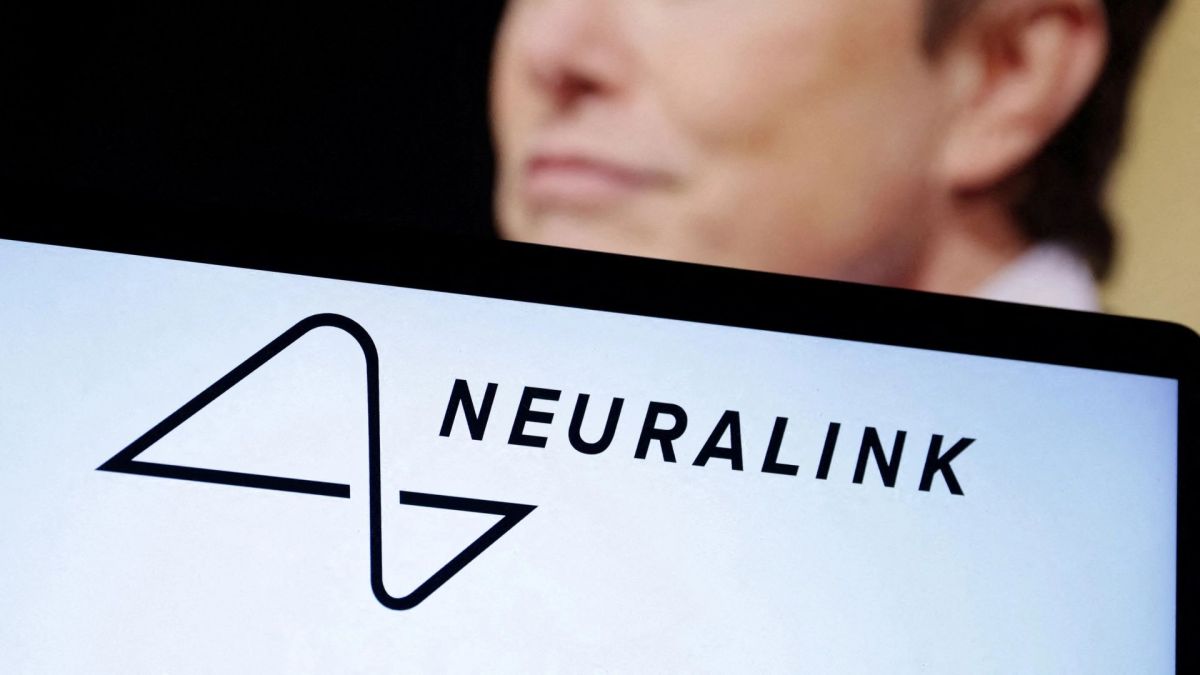 Neuralink Илона Маска вживила чип в мозг третьего пациента