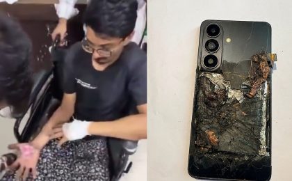 Смартфон Samsung Galaxy S26 взорвался и покалечил владельца